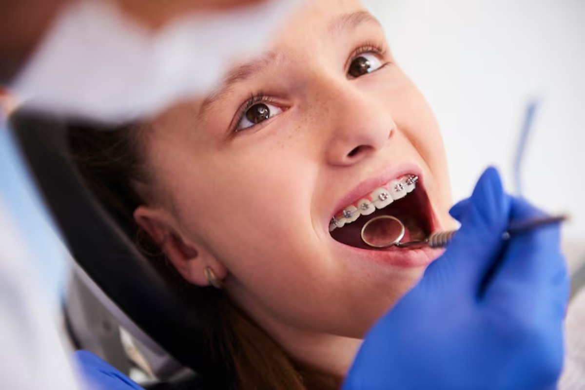 How Braces Support Early Jaw Development in Children