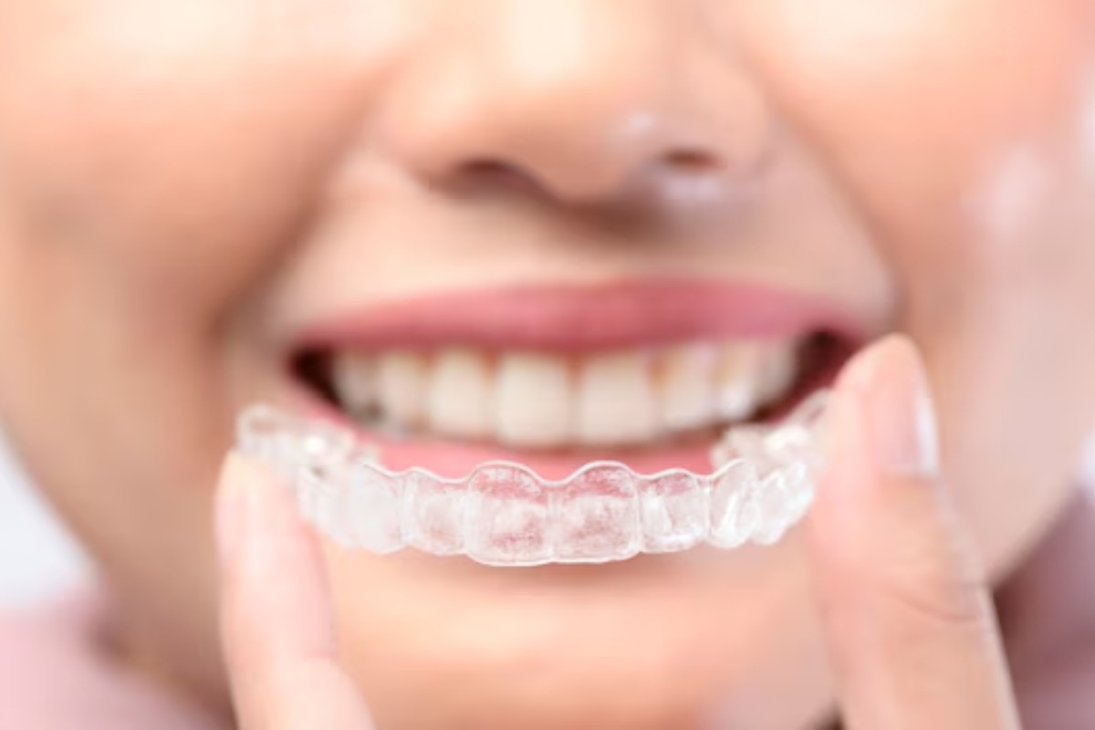 How Busy Adults Can Maintain Invisalign Aligners Easily