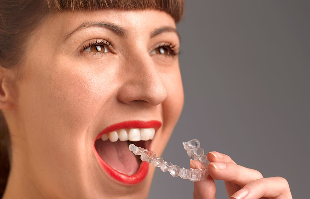 how does invisalign brighten your smile