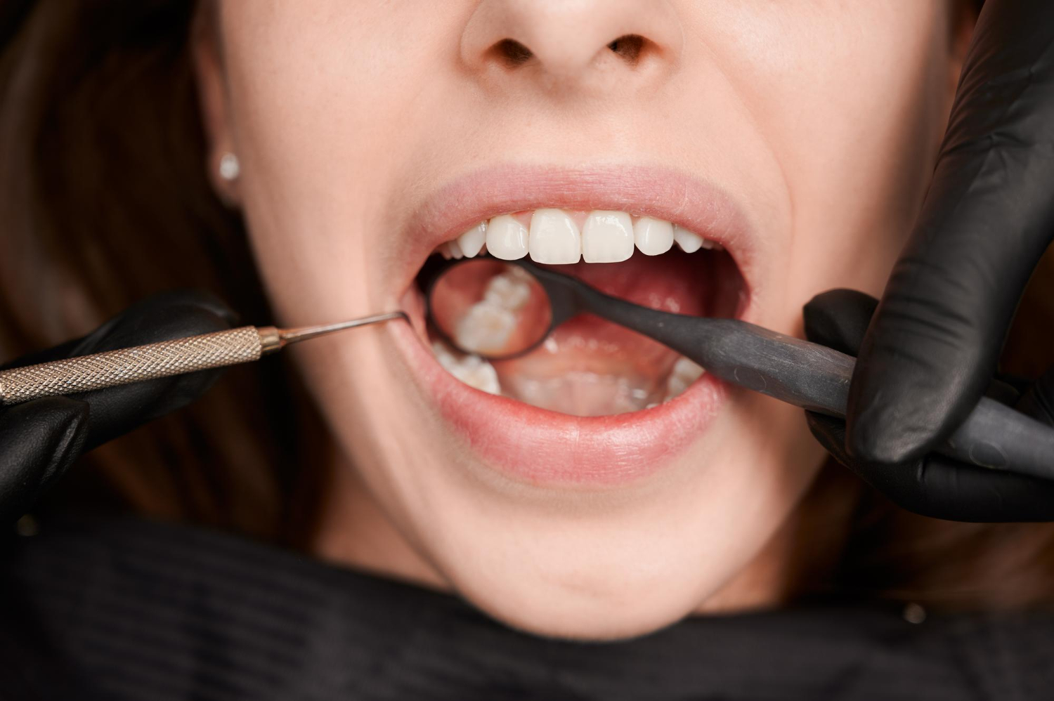 dental care same day tooth exrtraction near you