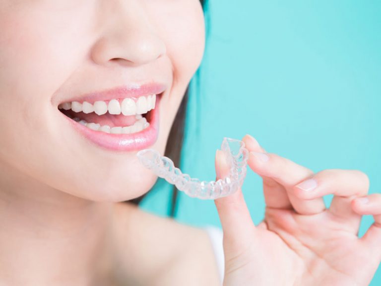 Invisalign in Orlando, Florida