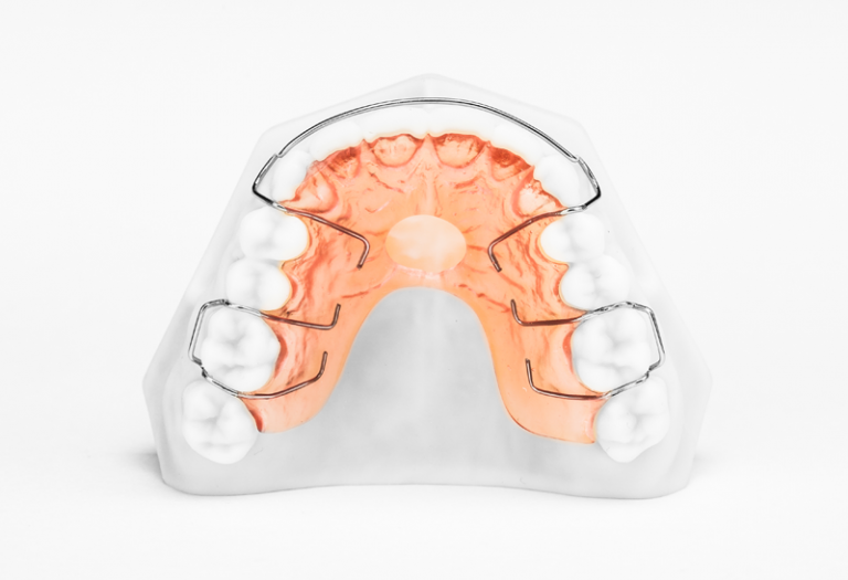 Hawley Retainer in Orlando Florida