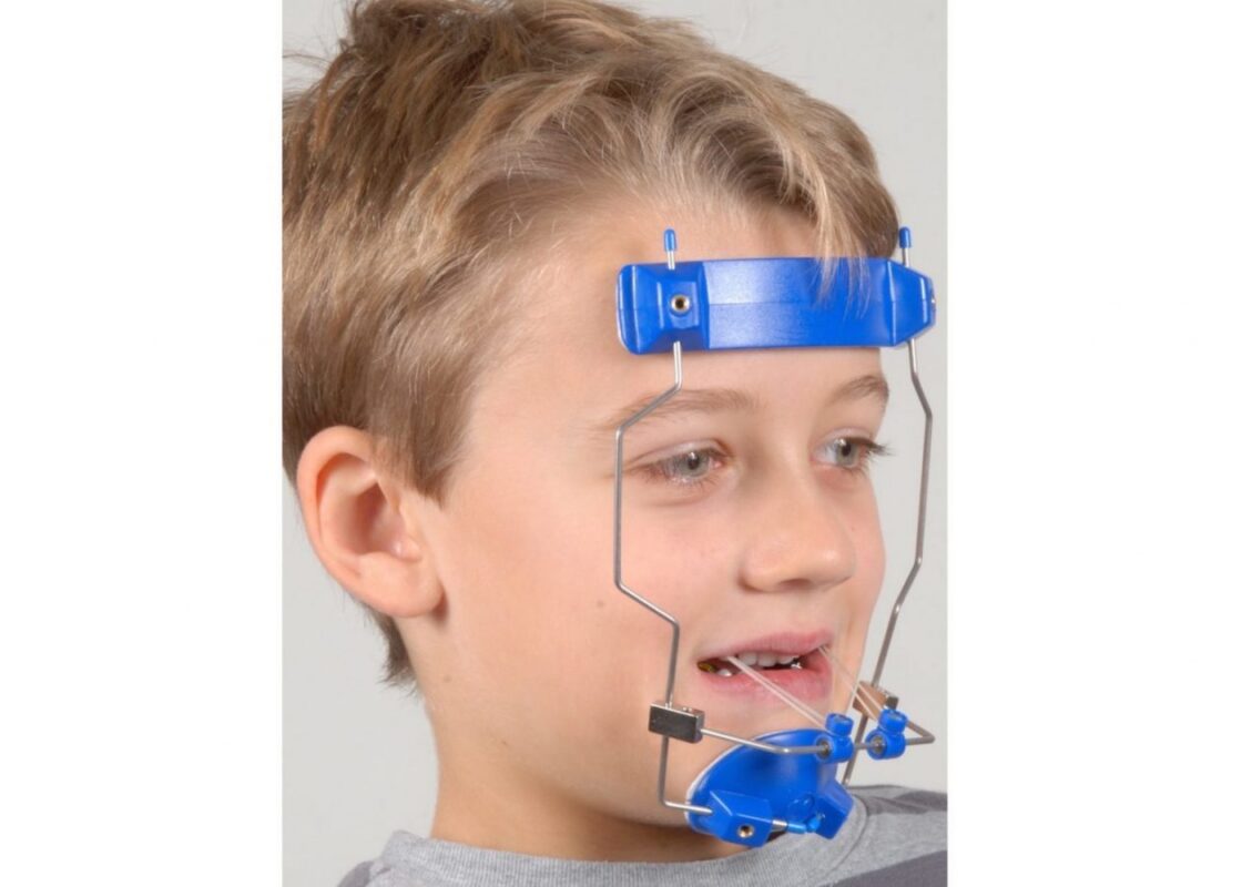 orthodontic headgear orlando